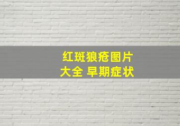 红斑狼疮图片大全 早期症状